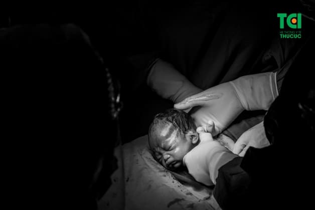 Lợi ích của đẻ mổ mẹ cần biết là rất quan trọng