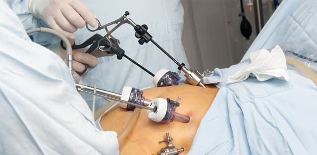 Viêm loét dạ dày có phải mổ không? &#8211; Góc giải đáp