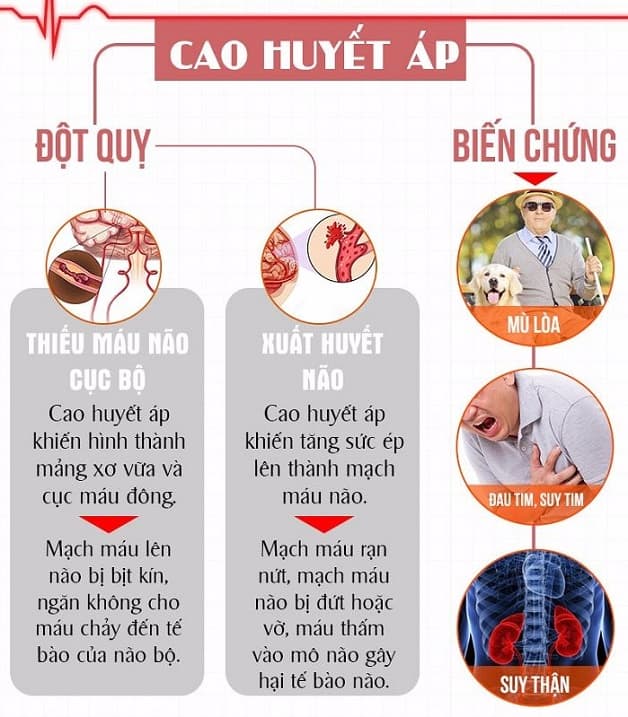 nguyên nhân gây tai biến do cao huyết áp