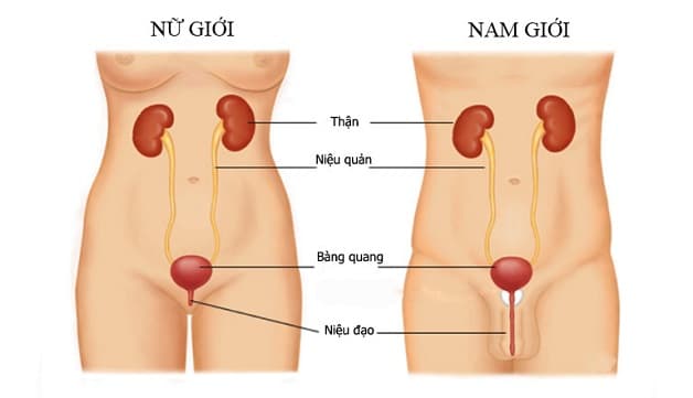 Sỏi thận rơi xuống niệu đạo