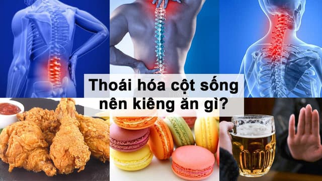 Thoái hóa cột sống nên kiêng ăn gì để nhanh khỏi bệnh?