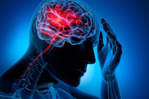 Đột quỵ có thể de dọa trực tiếp đến tính mạng người bệnh. 