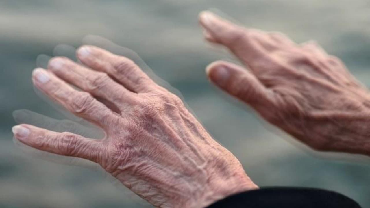 Bệnh Parkinson có đặc điểm gì?