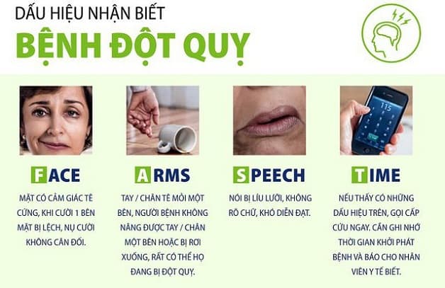 nhận biêt triệu chứng tai biến mạch máu não