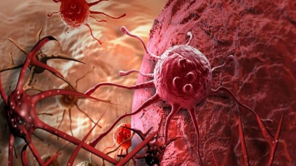 u gan và ung thư gan có khác nhau không