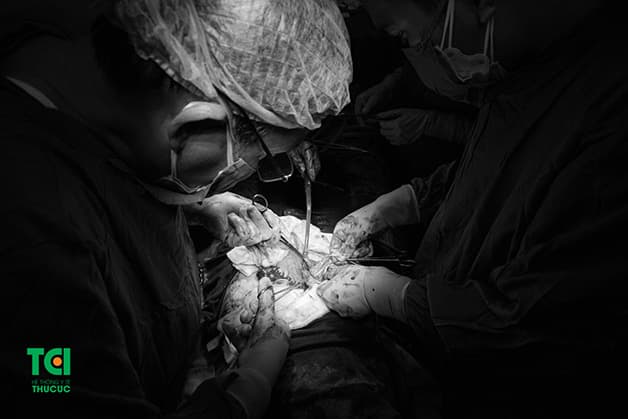 Loại bỏ khối u với phương pháp phẫu thuật cho hiệu quả nhanh chóng và an toàn với người bệnh