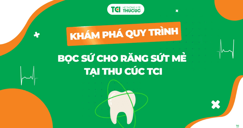 Khám phá quy trình bọc sứ cho răng sứt mẻ tại Thu Cúc TCI