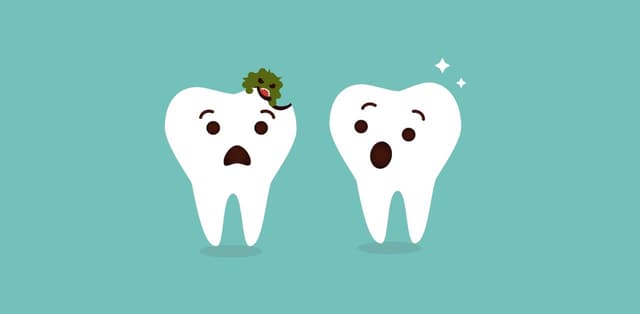 Sâu răng độ 3: Dấu hiệu nhận biết, cách điều trị dứt điểm