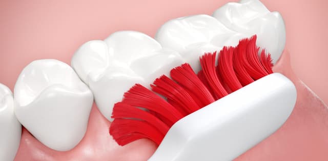 Bảo vệ răng đúng cách để răng không bị sâu