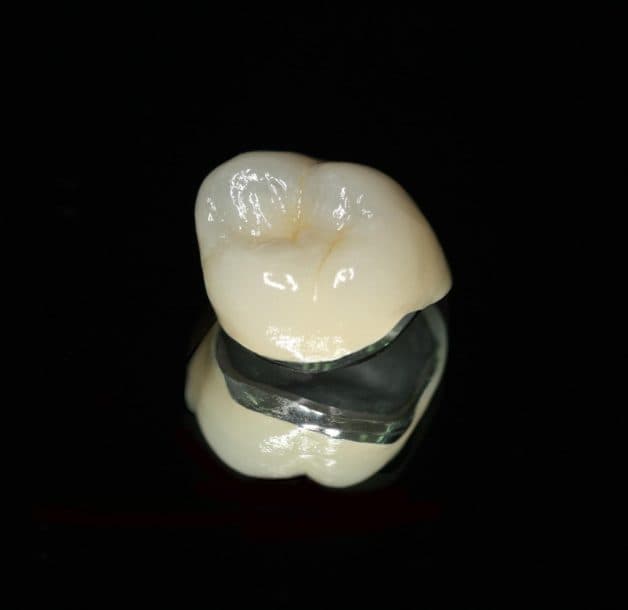 Răng sứ titan có cấu tạo 2 lớp: Lớp sứ bao bọc lớp titan.