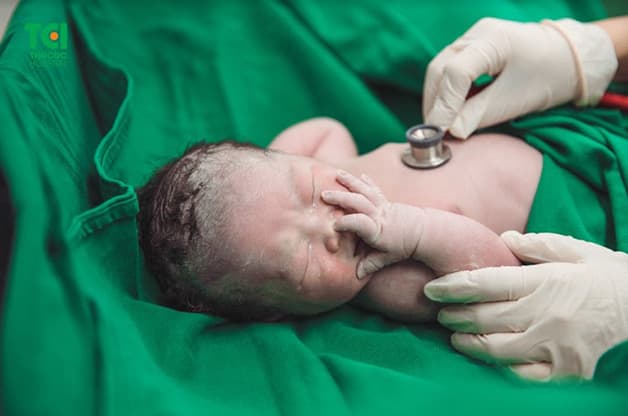 Em bé của mẹ Trương Thị Nguyệt chào đời khỏe mạnh, hồng hào, bụ bẫm