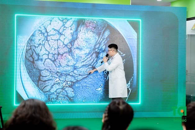 Tìm hiểu nội soi nhuộm màu có gì khác biệt