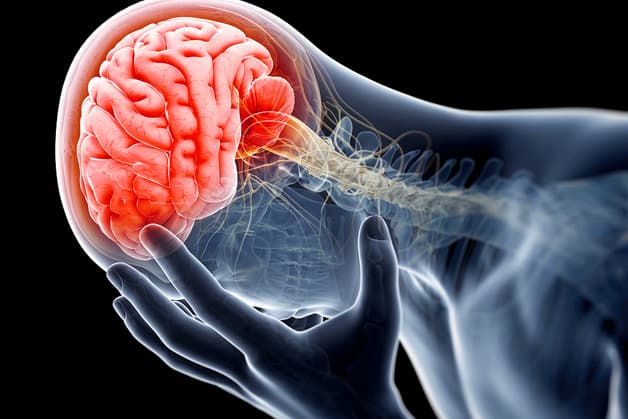 Đột quỵ xuất huyết não xảy ra khi các mạch máu bị vỡ khiến máu xâm lấn vào não gây tổn thương