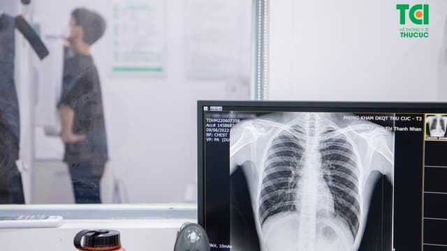 Tầm soát phổi có phát hiện ung thư không?