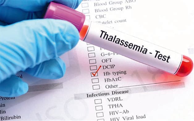 Thiếu máu mang gen Thalassemia gây nguy hiểm cho các mẹ bầu, đặc biệt là những mẹ bầu 