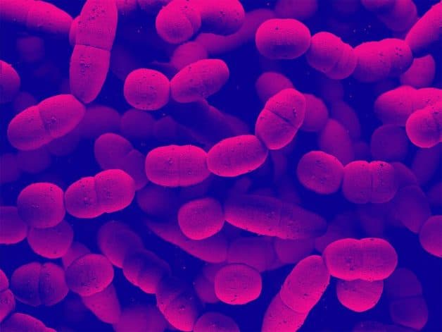 viêm hầu họng có thể phát sinh do hoạt động của liên cầu khuẩn Streptococcus nhóm A