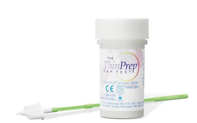 ung thư cổ tử cung