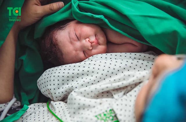 Mổ cấp cứu, “giải cứu” em bé không chịu ra ngoài do bất tương xứng đầu chậu