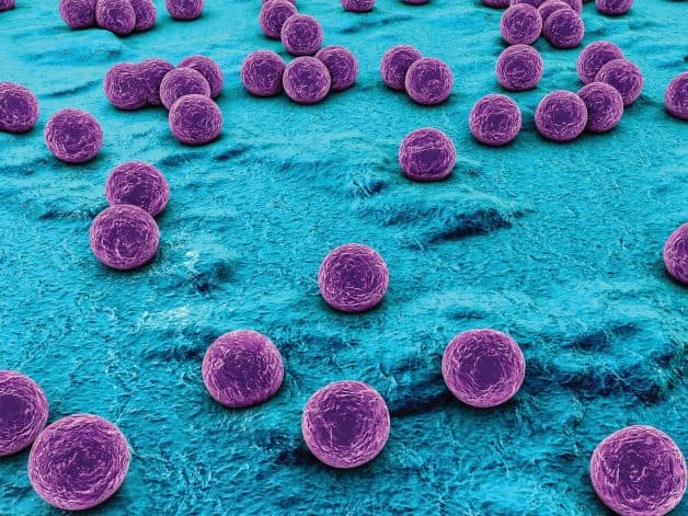 Nhiễm khuẩn Staphylococcus là nguyên nhân dẫn đến viêm bờ mi mắt tụ cầu