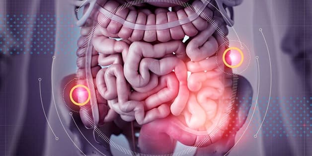 Phương pháp điều trị viêm đại tràng