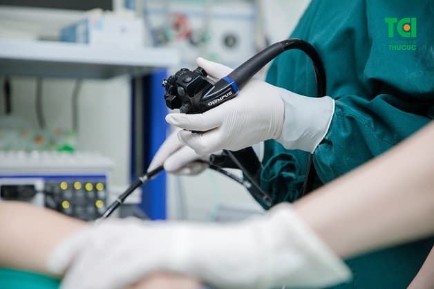 Nội soi dạ dày không đau