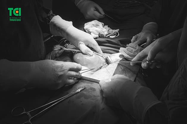 Sau sinh bị rong kinh, nguyên nhân có thể xuất phát từ một số bệnh phụ khoa liên quan tới tử cung, buồng trứng