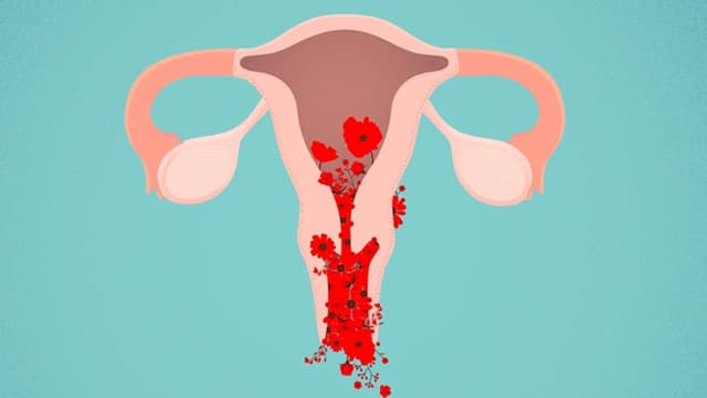 Vì sao phụ nữ sau sinh bị rong kinh? Cần khắc phục như thế nào?