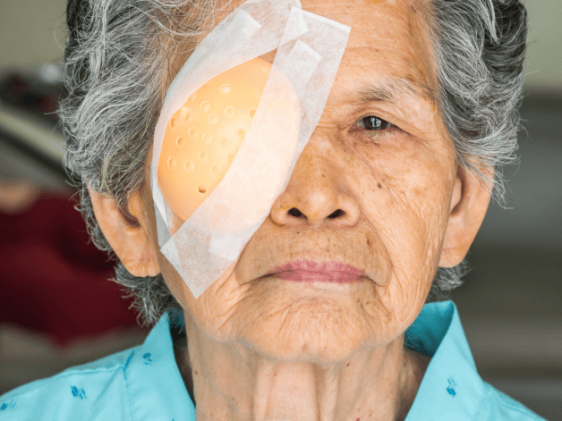 Viêm kết mạc có lây không? Viêm kết mạc có lây và khiến người mắc đau đớn, mệt mỏi