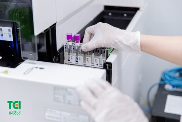 chi phí xét nghiệm ung thư cổ tử cung