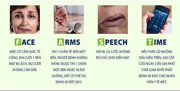 tai biến mạch máu não là gì? Dấu hiệu nhận biết