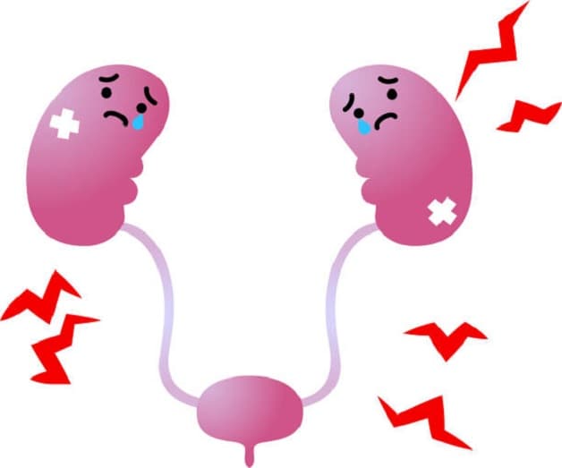 Điều trị sỏi kẹt niệu đạo như thế nào để đạt hiệu quả sạch sỏi triệt để