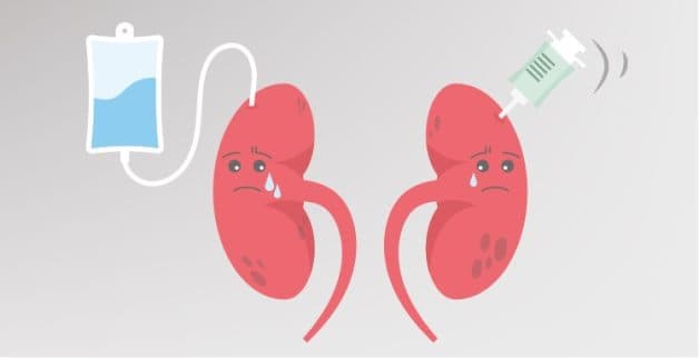 Giải đáp: Sỏi niệu quản có phải mổ không?