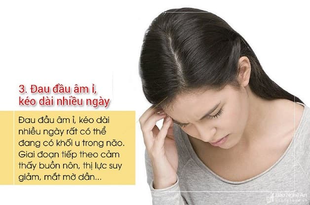Đau đầu 1 bên do u não