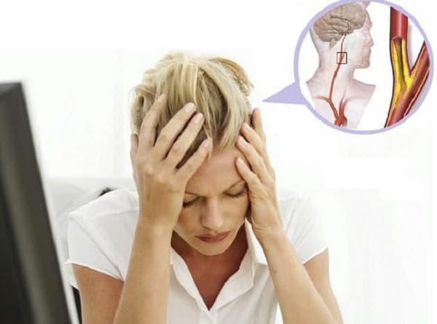 đau đầu 1 bên do thay đổi thời tiết 