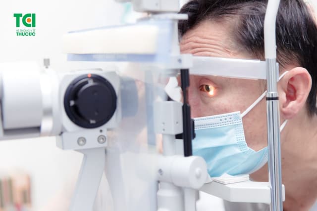 Đục thủy tinh thể bao sau: Nhận biết và điều trị