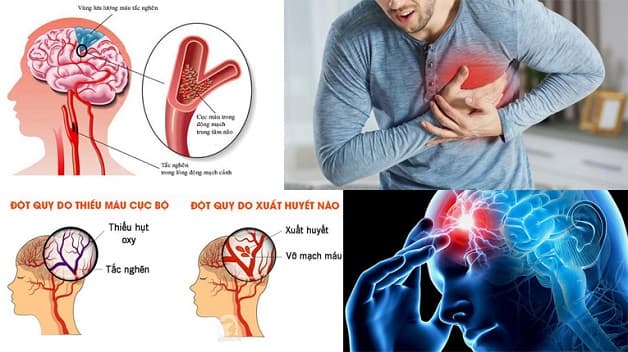 Mất ngủ trầm trọng gây bệnh lý thần kinh