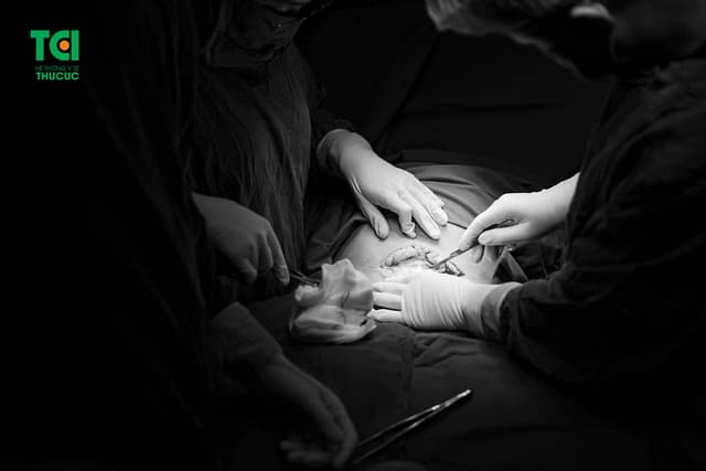 Mổ đẻ lần 3 và những thông tin mẹ bầu cần nắm rõ