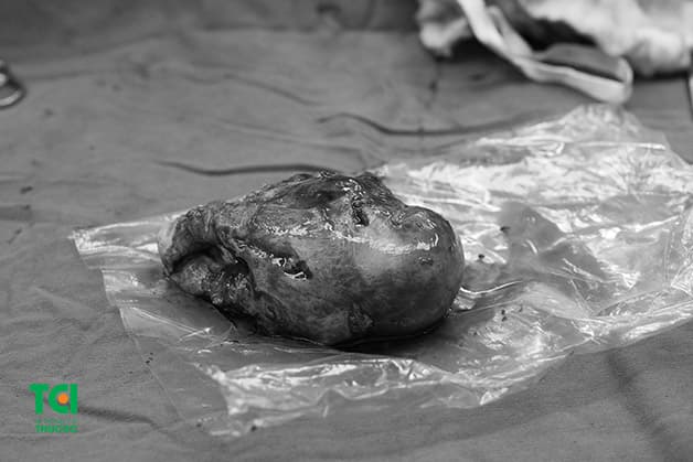 Một số bệnh phụ khoa có ảnh hưởng tới tử cung, buồng trứng cũng là nguyên nhân dẫn tới tình trạng kinh nguyệt không đều