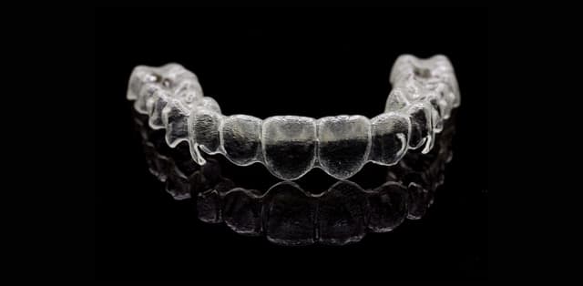 Niềng răng không mắc cài giá bao nhiêu, có cao không?