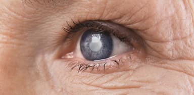 Thiên đầu thống là bệnh gì, có nguy hiểm không?