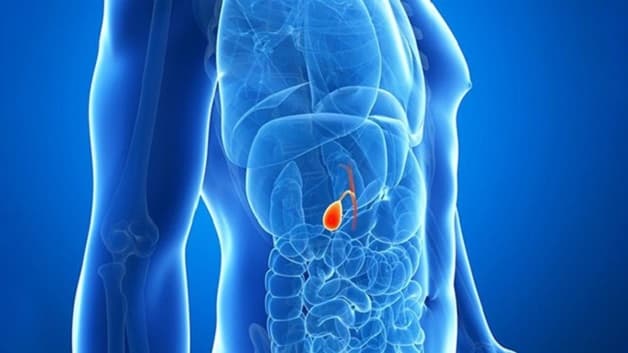 mổ mở cắt túi mật có biến chứng không