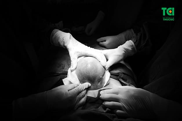 Những khối u có thể phát triển ở bất cứ vị trí nào tại tử cung