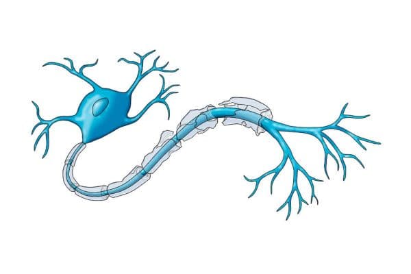 Quá trình viêm dẫn tới tổn thương myelin, trì hoãn tình trạng dẫn truyền tín hiệu và cản trở thị lực