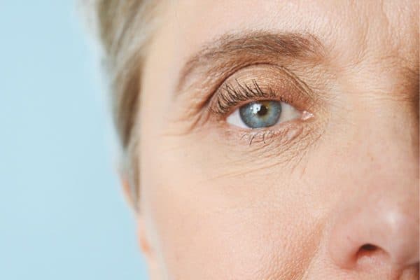 Bệnh sụp mí mắt có thể hình thành do cơ mí mắt bị ảnh hưởng bởi một số bệnh lý khu trú vùng mí mắt