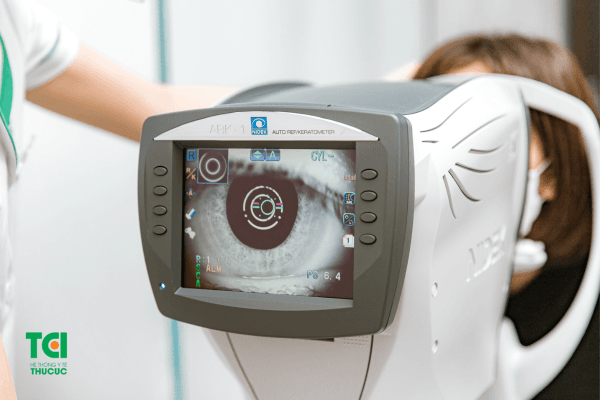 Chẩn đoán mộng thịt ở mắt bằng việc kiểm tra địa hình giác mạc, kiểm tra thị lực...