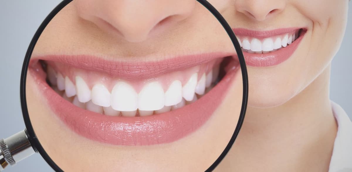 Bọc răng sứ quy trình được thực hiện như thế nào?