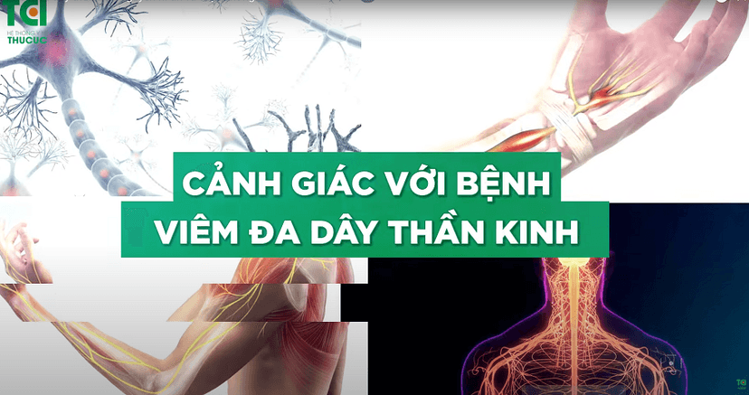Bệnh viêm đa dây thần kinh nguyên nhân và triệu chứng