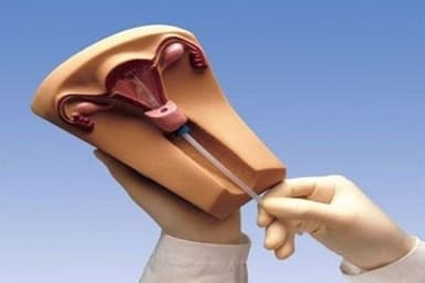 Phải làm sao khi đặt vòng bị rong kinh?