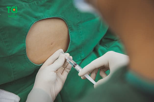 Việc bác sĩ sử dụng liều lượng thuốc gây tê không phù hợp cũng sẽ làm ảnh hưởng đến quá trình tiết sữa sau sinh của mẹ