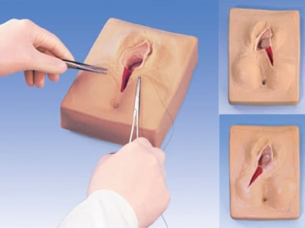 đẻ thường bị rạch